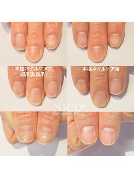 ニコプラス(NICO+)/ジェルネイルができない方向け