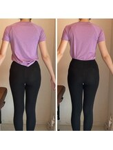 エスアップ 麻布十番店(THE S-UP)/施術前後写真