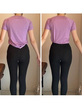 エスアップ 麻布十番店(THE S-UP)/施術前後写真