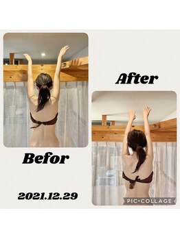 アンベリール(Embellir)/Before・After
