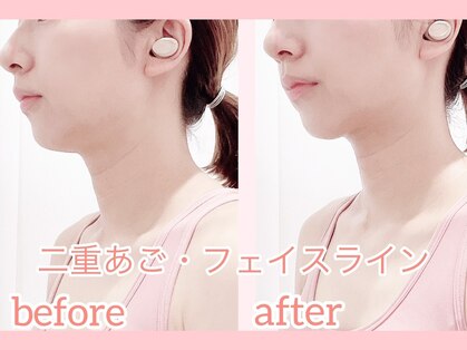 シェア(share)の写真