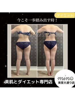 ミノ 美里大通り店(mino)/ダイエットパッケージ