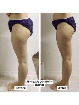 温美寺/最新機器導入!!