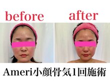 小顔矯正 アメリ ビューティーサロン(Ameri beauty salon)/韓国式コルギ小顔コース
