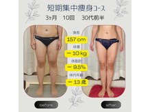 ティアエ(T-ae)/本気ヤセ【短期集中痩身コース】