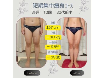 ティアエ(T-ae)/本気ヤセ【短期集中痩身コース】
