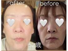 ヒーリングサロン イチマルイチ(101)/白玉＆アルファワン