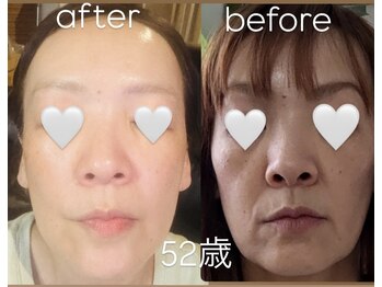 ヒーリングサロン イチマルイチ(101)/白玉&アルファワン