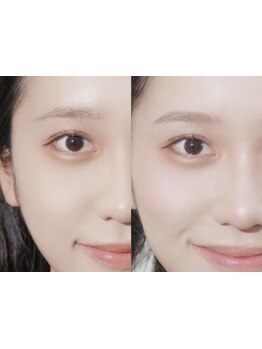 アイブロウメニューがあるサロン