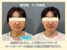 晴々の雰囲気(50代女性の変化!顔のむくみ、バランスが良くなっています!!)