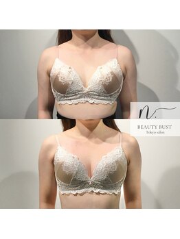 エヌドット 日本橋(N.)の写真/【小胸さん/脂肪が少ない方/卒乳後のお母様にも◎】希少なオールハンドの技術で美しいバストラインに♪