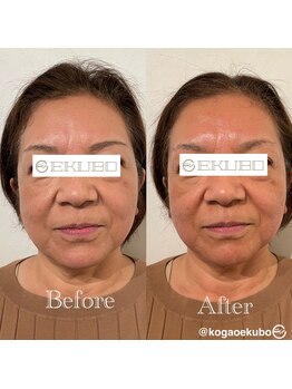 エクボ 立川店(EKUBO)/