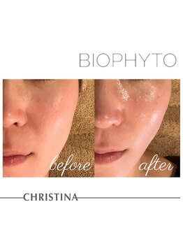 サロン ド ブラン アオヤマ(Salon de BLANC AOYAMA)/CHRISTINAビオフィート