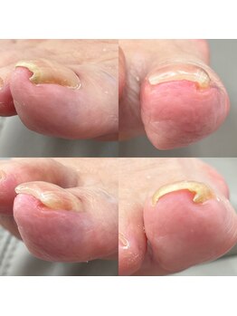 ウェルズユキ(well's yuki)/