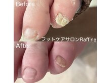 ラフィネ(Raffine)の雰囲気（厚みや段差もキレイに整えます）