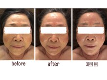 salon結(yui)/小顔筋膜ケア