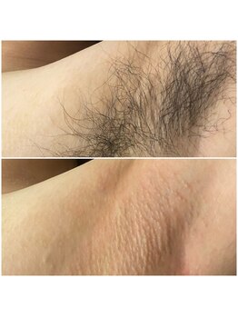 シュク(SHUKU)/脇シュガーリング