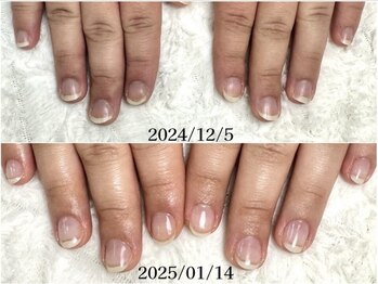 グラシナ 鳥丸店/フィルイン対応で傷つけない