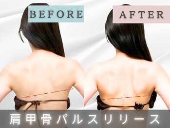 エルシンメトリー矯正院(ailesシンメトリー矯正院)/before＆after　肩甲骨電気