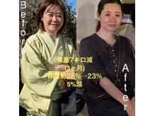 過度な食事制限、激しい運動なしでサイズダウン！(耳つぼ/痩身)