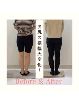スタイルラボ高松/産後の骨盤矯正の効果♪