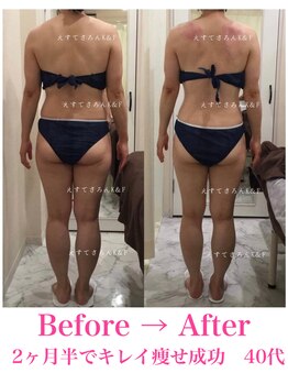 えすてさろん ケイアンドエフ(k&f)/施術結果2ヶ月半/40代