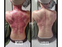 オアシス(OASIS)/デトックスかっさ