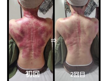 オアシス(OASIS)/デトックスかっさ