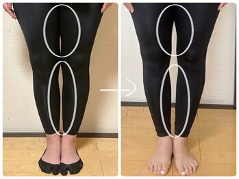 高槻 インサイド(Inside)/ビフォー・アフター