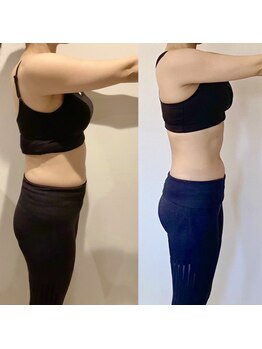 ザ スター(the STAR)/3ヶ月ビフォーアフター★