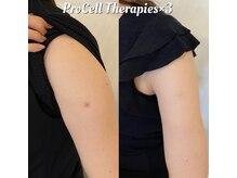 叶(Kanau)/プロセルセラピーズ