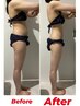 なかなか痩せない下半身に集中アプローチ 脂肪分解×デトックス60分￥9900