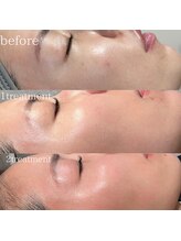 カラーズ(COLOURS)/プロセル×エクストラクション