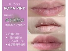 アンヘル(Angel)の雰囲気（最新技術で黒ずみケア）