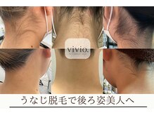ヴィヴィオドット(vivio.)の雰囲気（うなじ脱毛で、後ろ姿まで美しく整えたい方におすすめ◎）