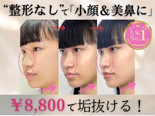 隆鼻矯正専門店 ラプリセレネ (Raplit Selene)/隆鼻+輪郭矯正(小顔)40分30回