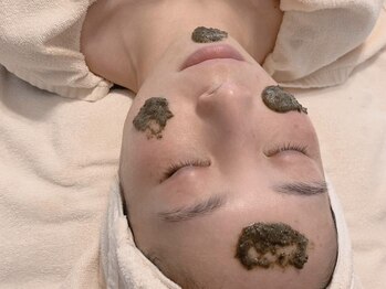 マナ(Mana)の写真/本気で肌を変えたい大人女性へ！グリーンピール＆REVIの本格ハーブケアで健やかな“育てる美肌”へ