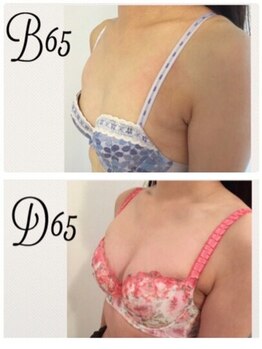 美人バスト 渋谷店/【バストアップ・育乳】◇症例◇