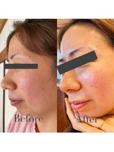 エヌ アンド エイチ ソニックフィット(N&H sonicfit)/お肌のエイジングケアコース