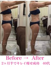 えすてさろん ケイアンドエフ(k&f)/施術結果2ヶ月半/40代