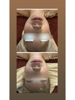 ビンナ 五反田店(Binna)/写真撮影前やブライダルに