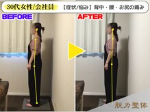 幸せのもり整体院/【30代女性／会社員】Uさん