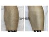 ☆初心者歓迎☆【メンズ全身脱毛】お忙しい方もスピーディーに◎