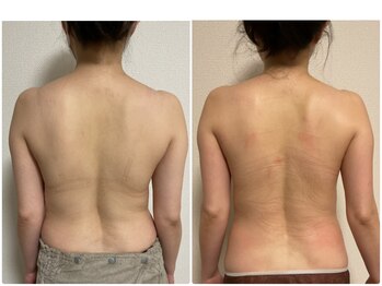 美 プラス(美 Plus)/【30代】背中の歪み・骨盤の開き