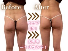 ディオネ/痩身ビフォーアフター【6ヶ月】
