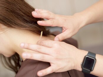 リアライズ(realise)/◆鍼灸/眼精疲労/不眠/頭痛