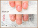 【自爪育成コース】