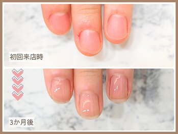 ルシェルアイ/【自爪育成コース】