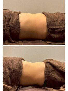 ビュウナ 銀座(BEAUNA)/マルチウェーブリフト