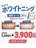 【セルフホワイトニング】30分で白さ実感♪何回でもOK  5,000円→3,900円